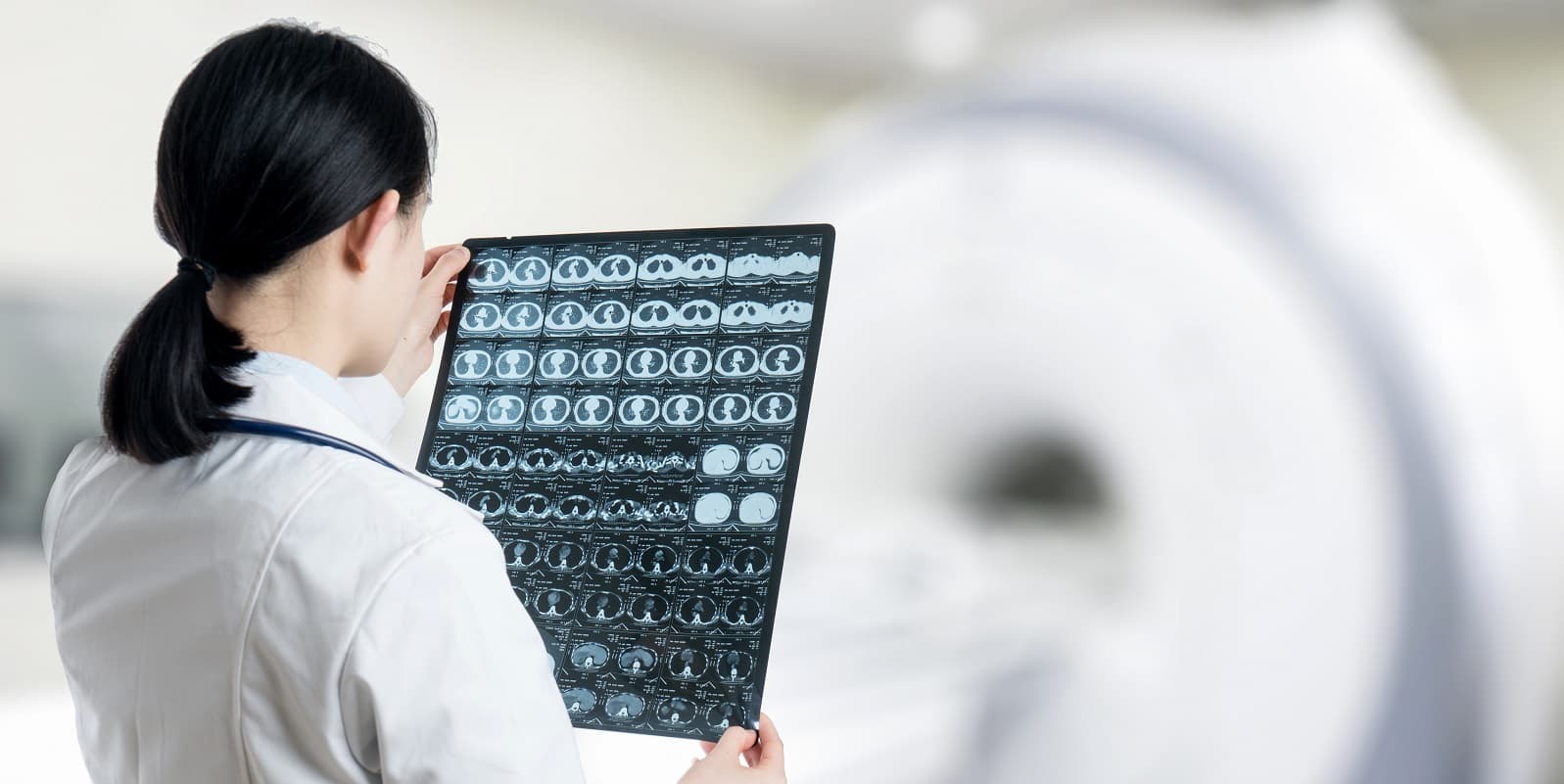 stroke ct scan interpretation