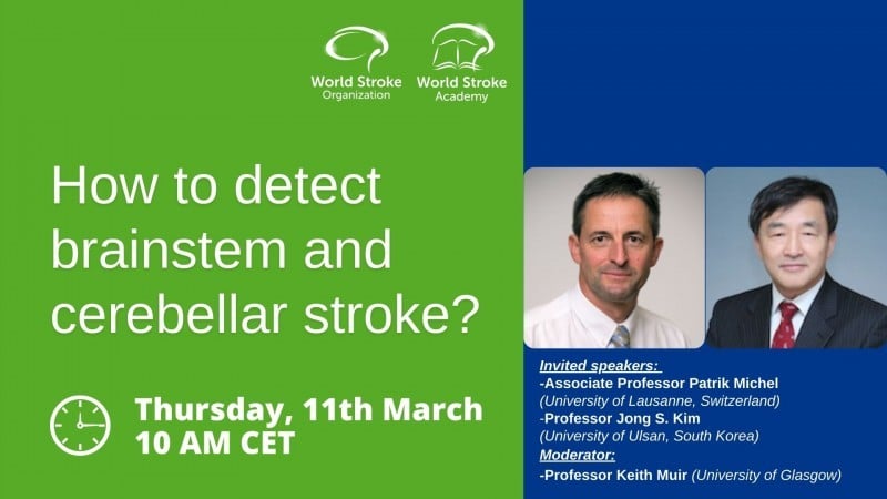 How to detect brain stem and cerebellar stroke?