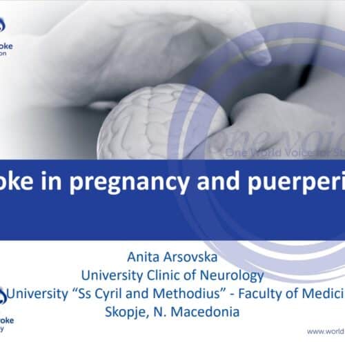 Stroke in pregnancy and puerperium - Anita Arsovska